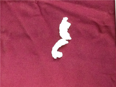 图1 根据患者3D模型制作的个体化植钉导向器.JPG