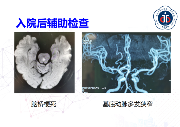 术前1_副本.png